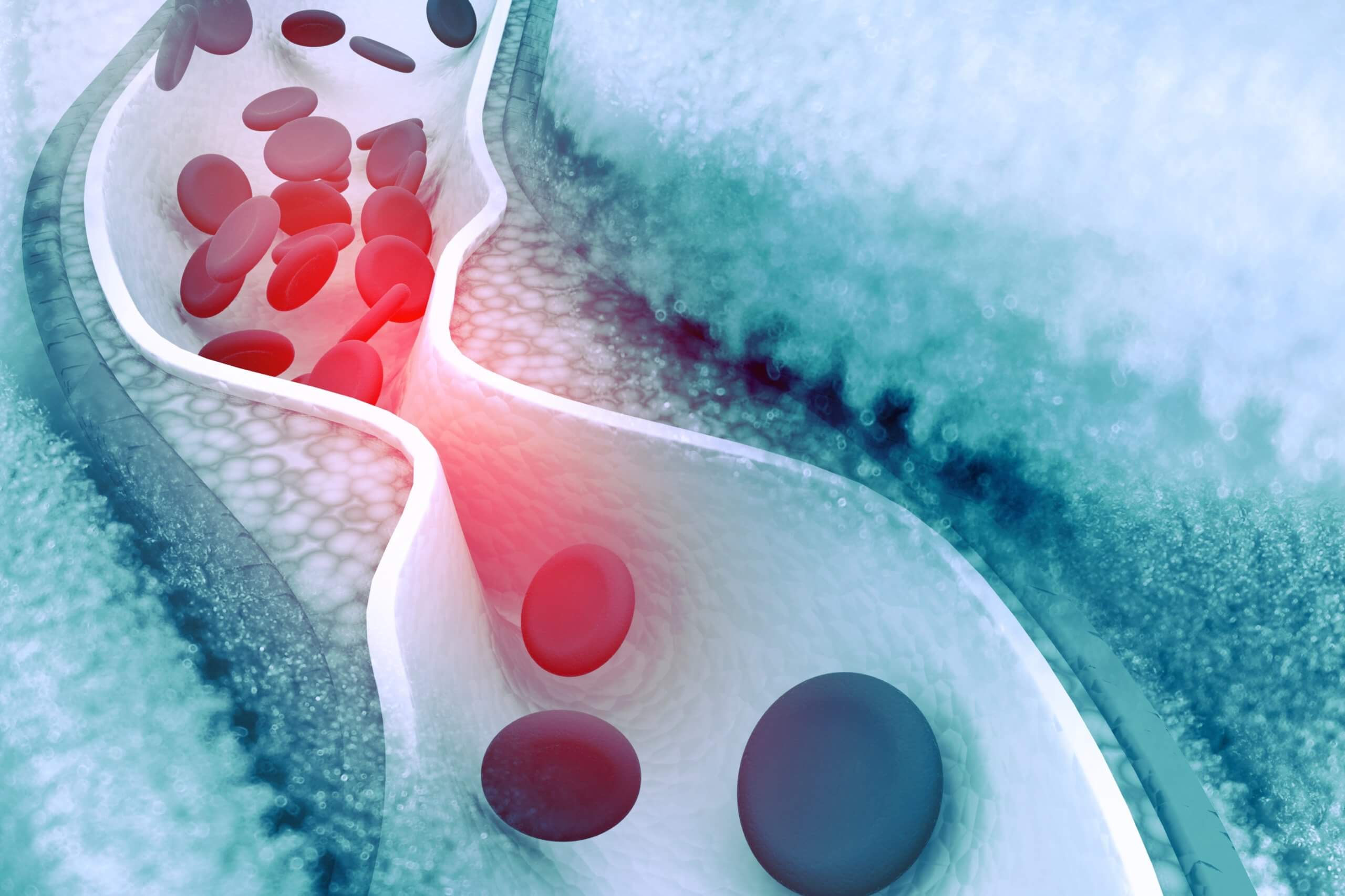 Habits That Lower The Risks Of A Stroke GreenTree At Westwood